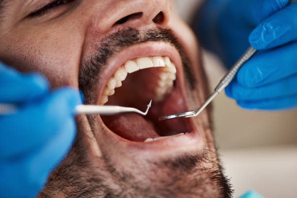 Best Walk-In Emergency Dentist in Pinehurst, ID